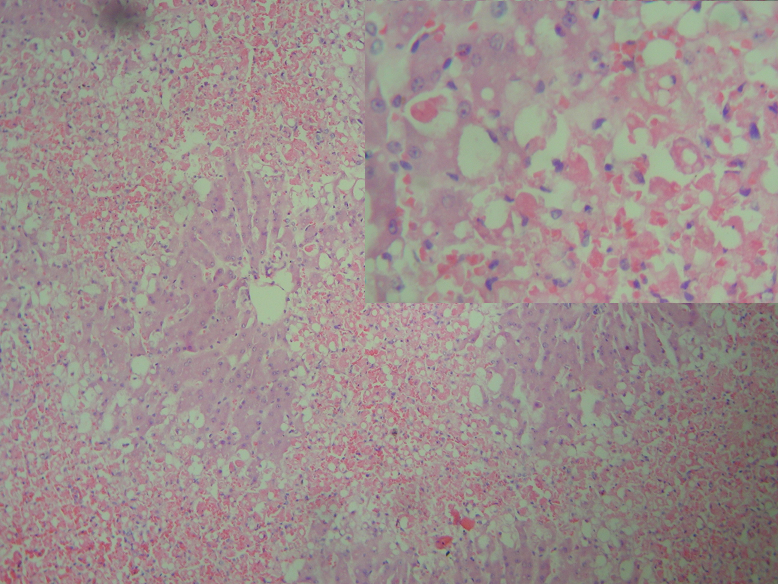 肝血窦显微镜图片