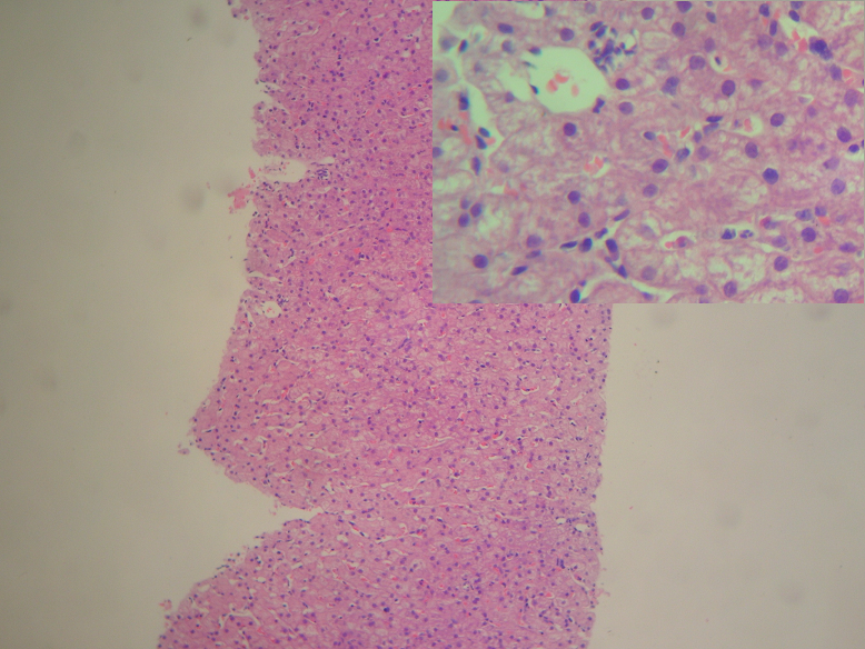 肝血窦显微镜图片